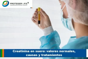 Creatina en Suero