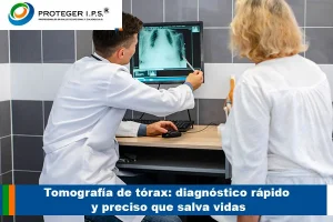 tomografia de toraz