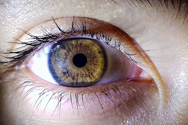 Cornea Anterior