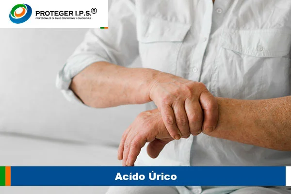 acido urico