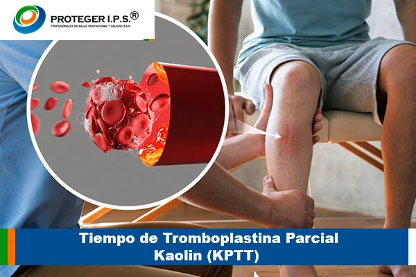 Tiempo de Tromboplastina Parcial Kaolin (KPTT)