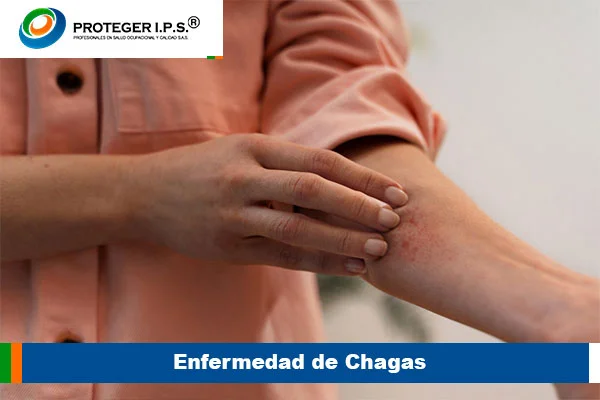 Enfermedad de Chagas