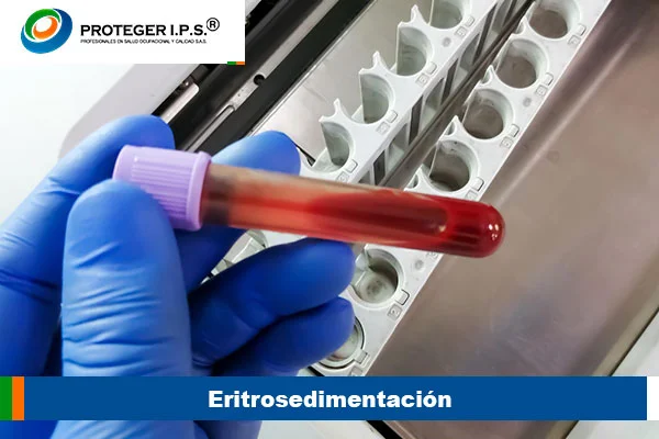 eritrosedimentación