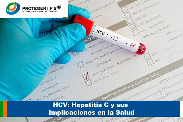 HCV: Hepatitis C y sus Implicaciones en la Salud