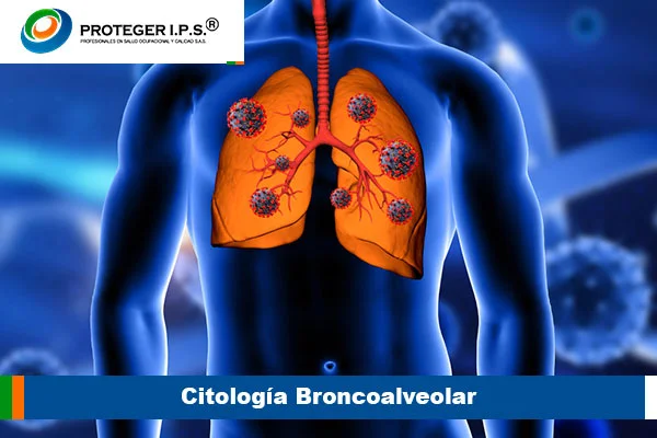 Citología Broncoalveolar