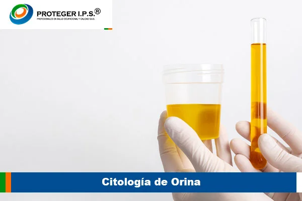 Citología de Orina