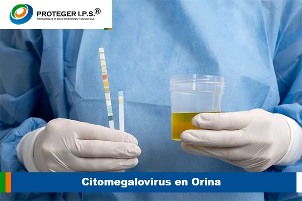 Citomegalovirus en Orina