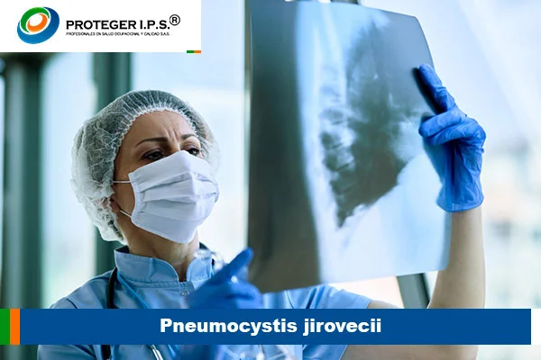 Pneumocystis jirovecii