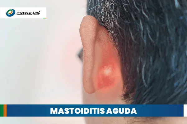 mastoiditis