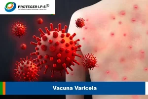 Vacuna varicela