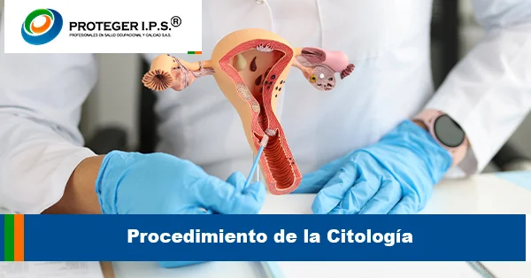 Procedimiento de la Citología