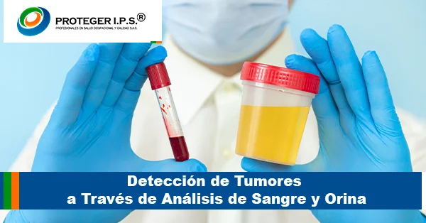 Detección a Través de Análisis de Sangre y Orina