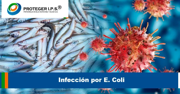 Infección por E. coli