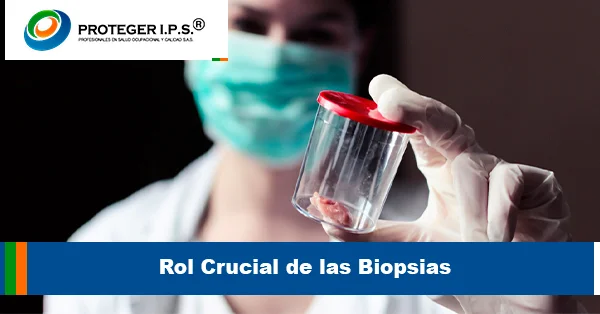 Rol Crucial de las Biopsias