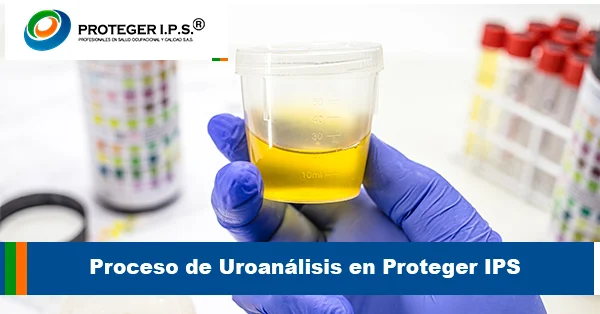 Proceso de Uroanálisis en Proteger IPS