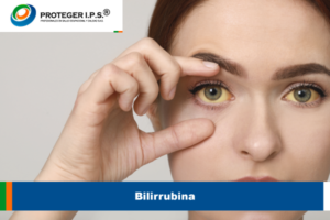 Bilirrubina