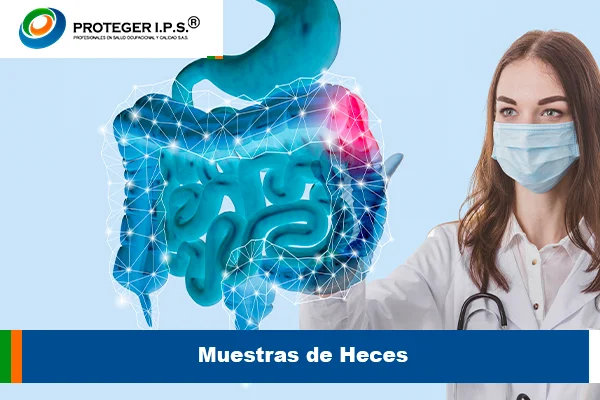 Muestras de Heces