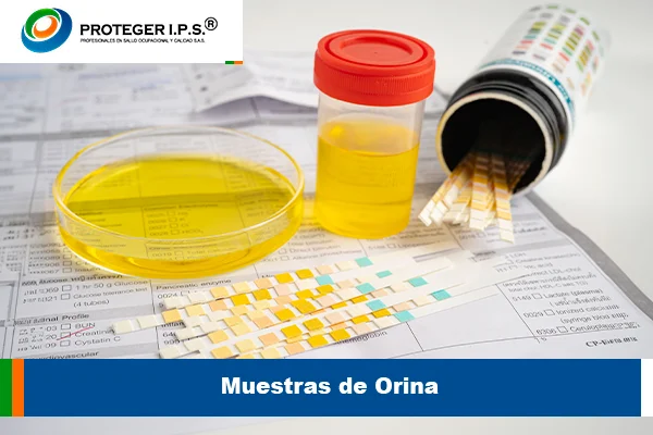 Muestras de Orina