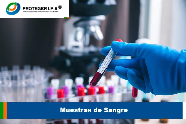 Muestras de Sangre