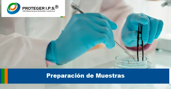 Preparación de Muestras