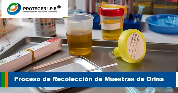 Proceso de Recolección de Muestras de Orina