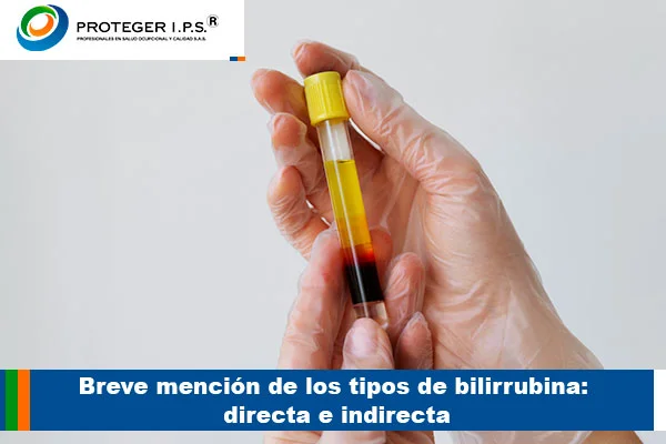 bilirubina directa