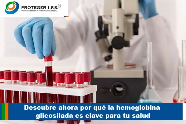 hemoglobina glicosilada