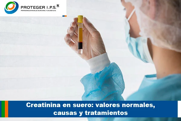 Creatina en Suero