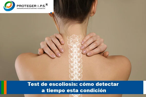 escoliosis