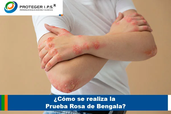 prueba de bengala