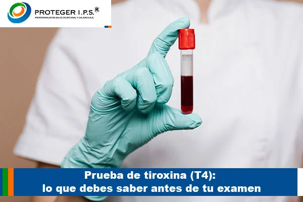 prueba de tiroxina