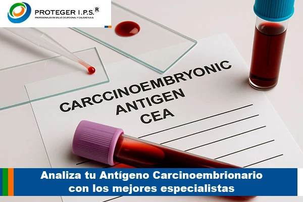 antigeno carcinoembrionario