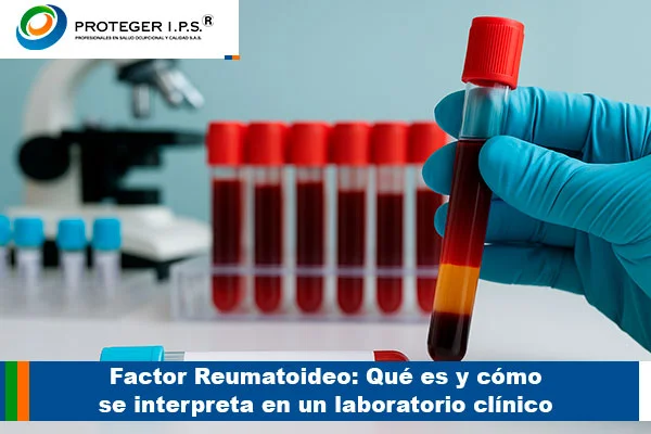factor reumatoideo