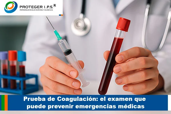 prueba de coagulacion