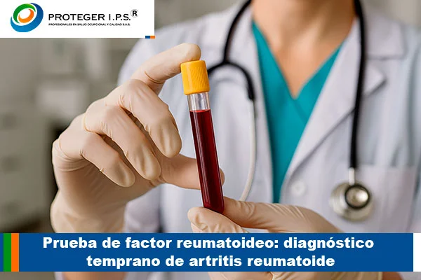 prueba de factor reumatoideo