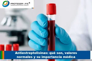 Antiestreptolisinas