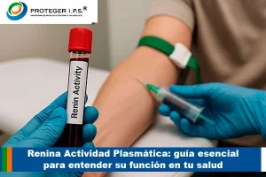 Renina Actividad Plasmática