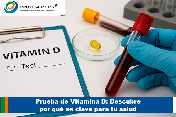 prueba de vitamina d