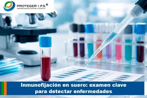 Inmunofijación en suero