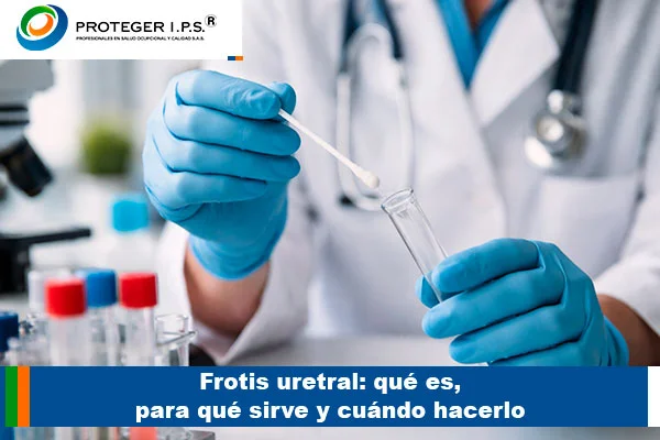frotis uretral
