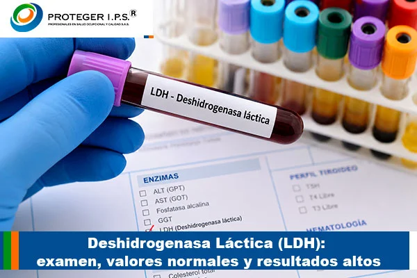Deshidrogenasa Láctica