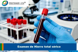 hierro total serico