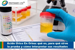 Ácido Úrico En Orina