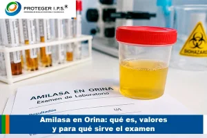 Amilasa en orina y evaluación de laboratorio clínico.
