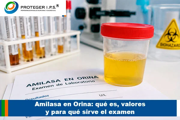 Amilasa en orina y evaluación de laboratorio clínico.
