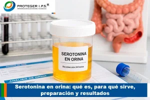 serotonina en orina
