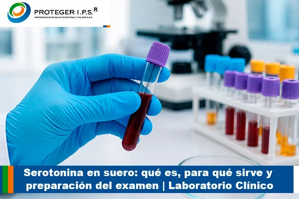 serotonina en suero