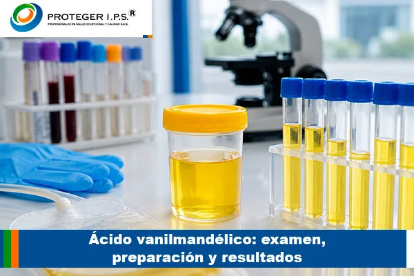 Ácido vanilmandélico