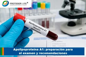 Apolipoproteína A1