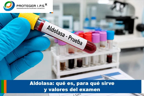 aldolasa